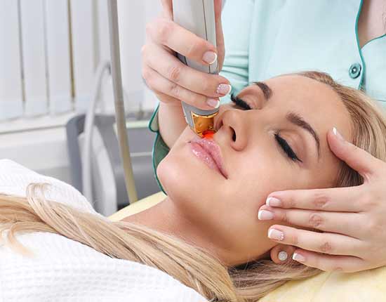 Laser hair removal treatment of upper lip